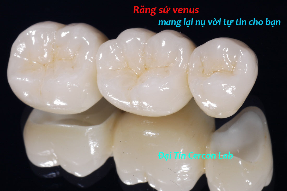 răng sứ Venus